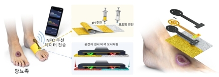국립한밭대·KAIST 공동연구팀, 당뇨 합병증 조기 경고 가능한 웨어러블 기술 구현